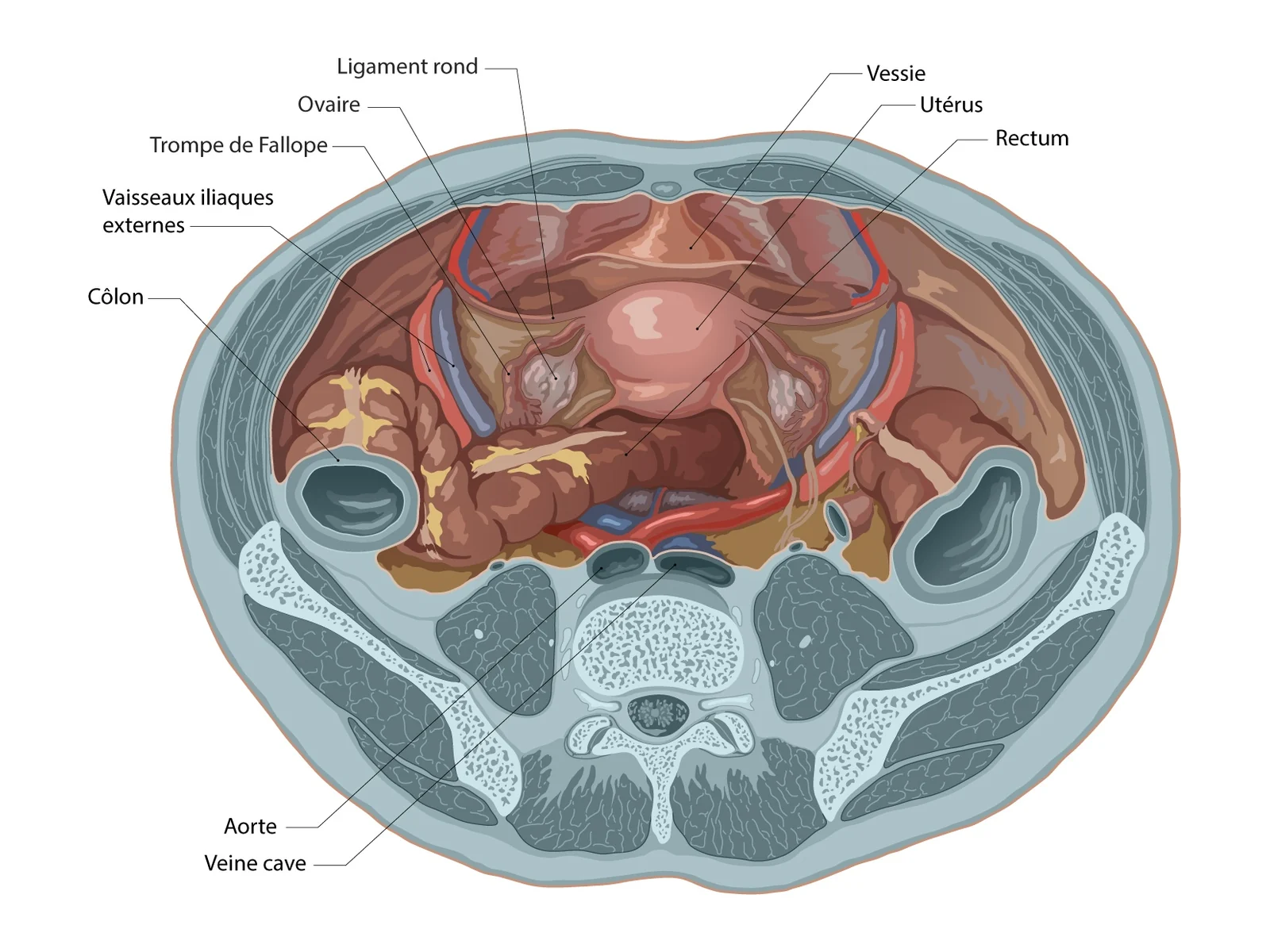 Bassin féminin, vue supérieure — Coupe axiale annotée : utérus, ovaires, trompes, vessie et rectum, entourés des vaisseaux iliaques et du côlon.